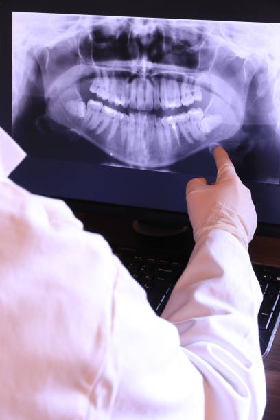 Best After-Hours Emergency Dentist in New Chicago, IN