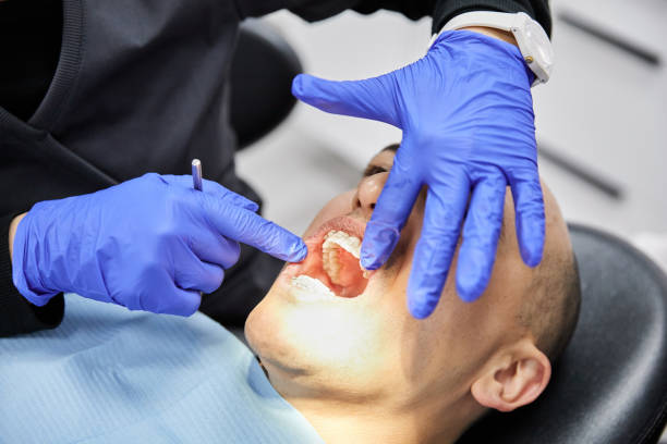 Best Emergency Broken Tooth Repair in New Chicago, IN