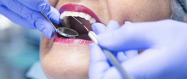Best Emergency Root Canal Treatment in New Chicago, IN